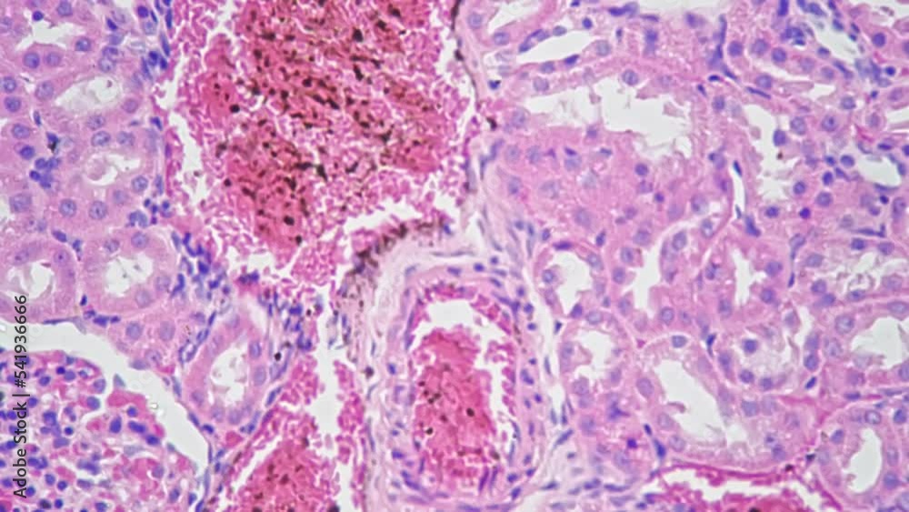 custom made wallpaper toronto digitalSection of artery and vein under microscope with 400 times magnification filmed on bright field. Research of blood vessels and cells. Scientific and medical. System of transferring important elements.