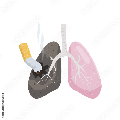 Healthy and smoker's lungs  