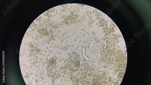 strongyloides stercoralis larva in stool exam finding with microscope 40X. photo