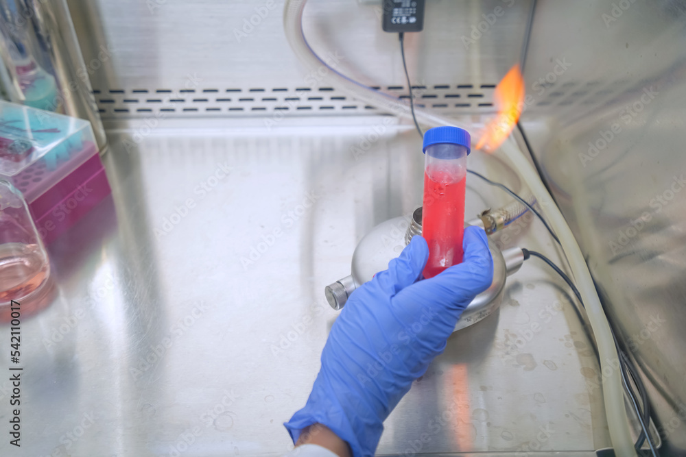 The researcher using bunsen burner to sterile technique for kill the