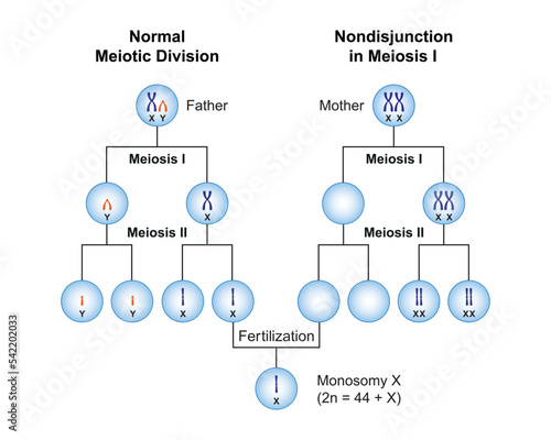Scientific Designing of Nondisjunction in Monosomy X (Turner Syndrome) . Colorful Symbols. Vector Illustration. photo