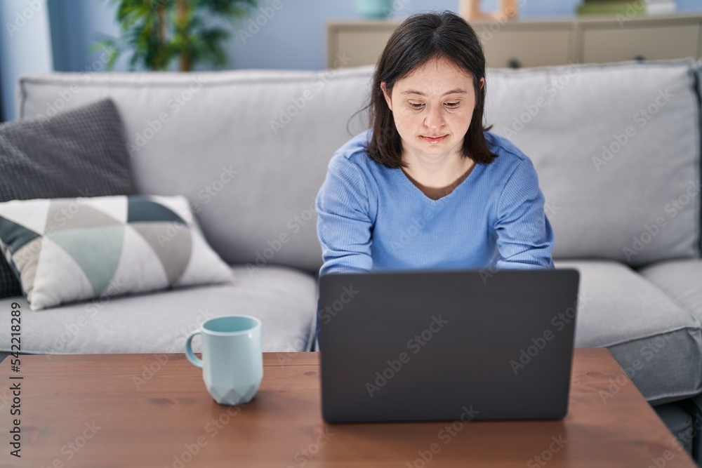 Young woman with down syndrome using laptop and drinking coffee sitting on sofa at home Young woman with down syndrome using laptop and drinking coffee sitting on sofa at home