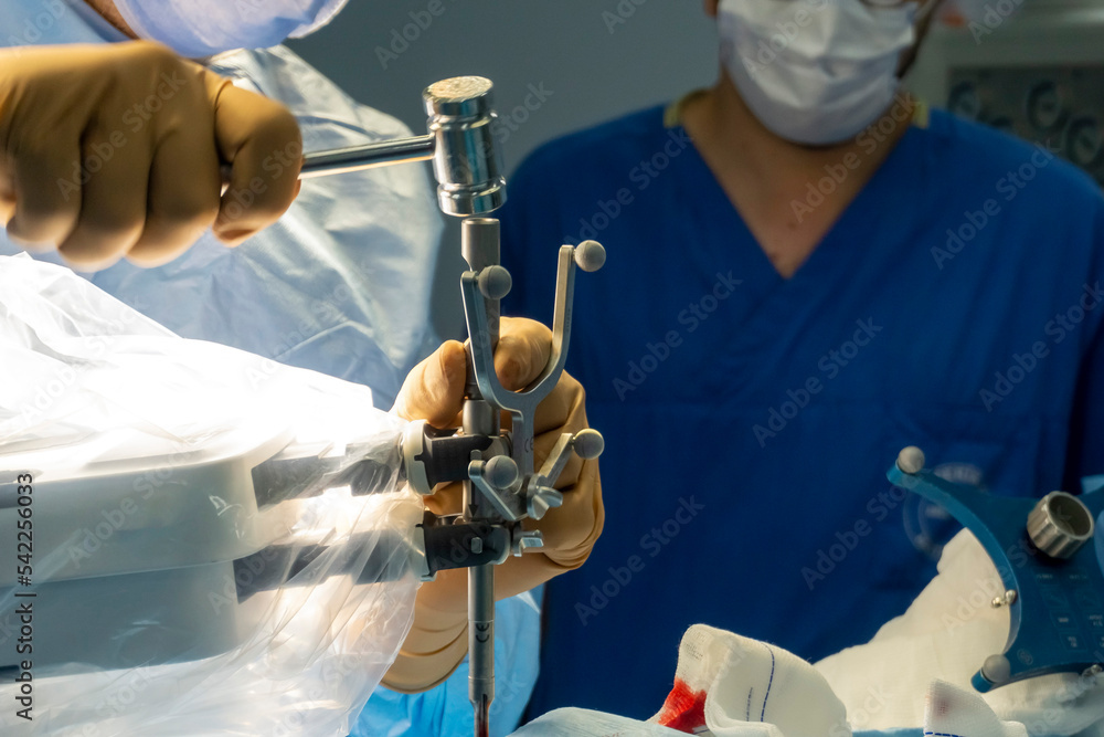 Step by step Visualase is an MRIguided laser ablation system used to