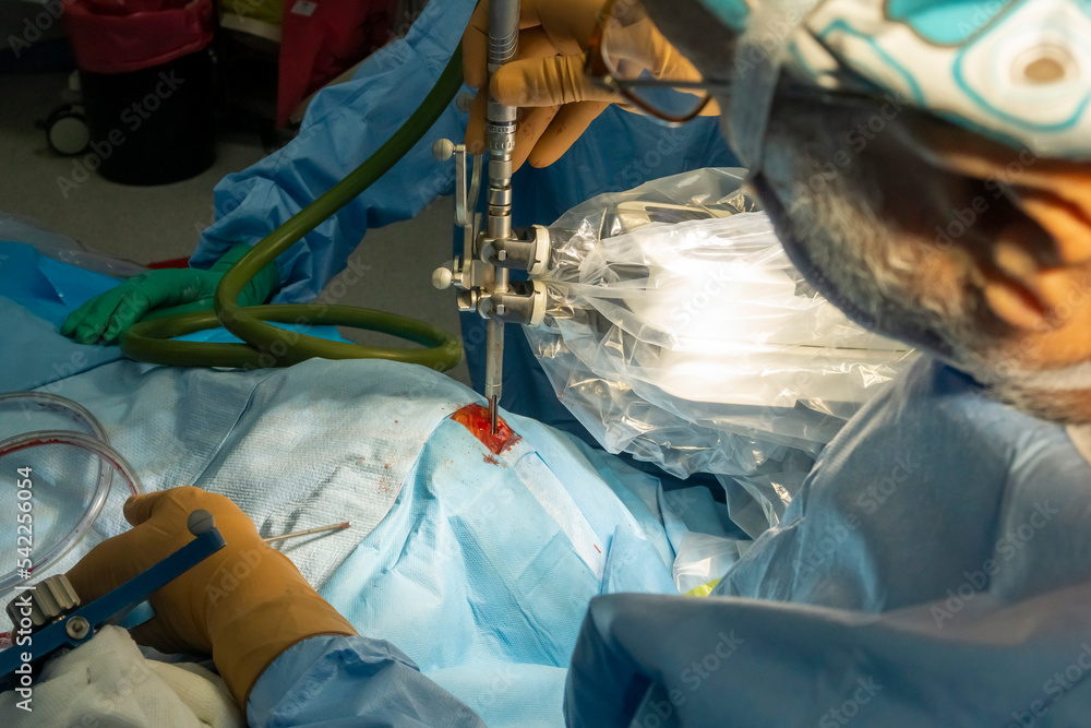 Step by step Visualase is an MRIguided laser ablation system used to