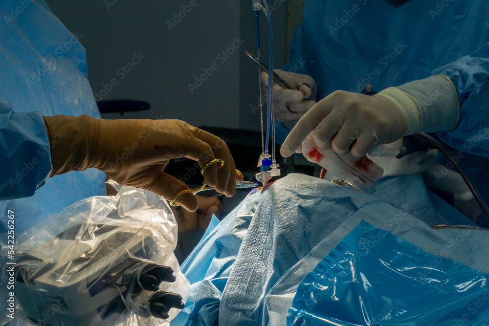 Step by step Visualase is an MRI-guided laser ablation system used to ...