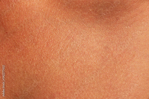 Brown human skin texture. Sunburned woman skin closeup photo