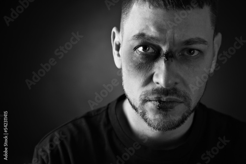 Photos Man with facial injuries on dark background, space for text