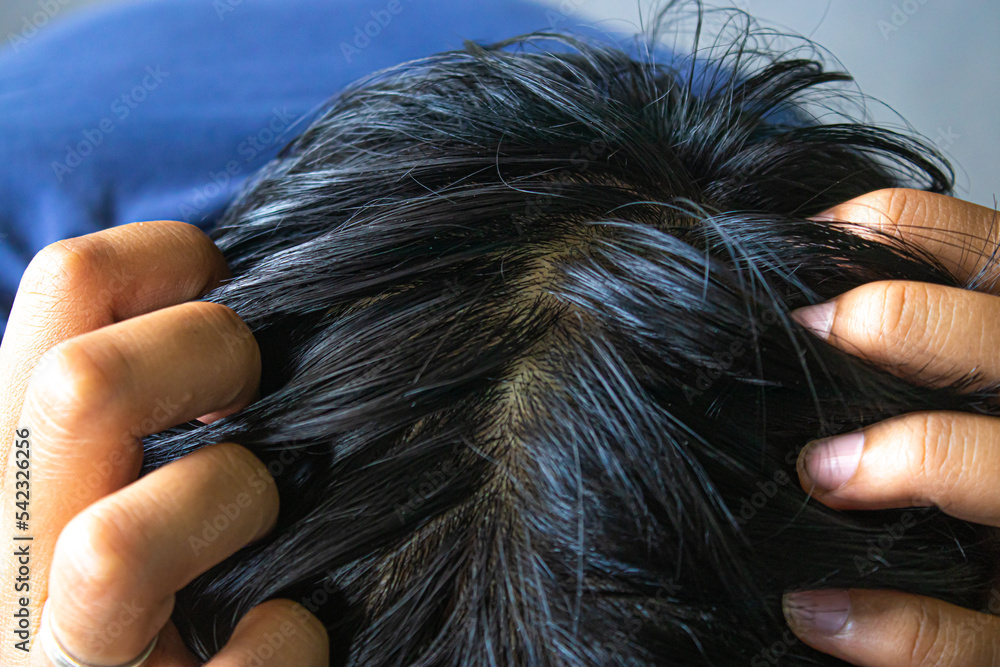 Coarse Hair Close Up