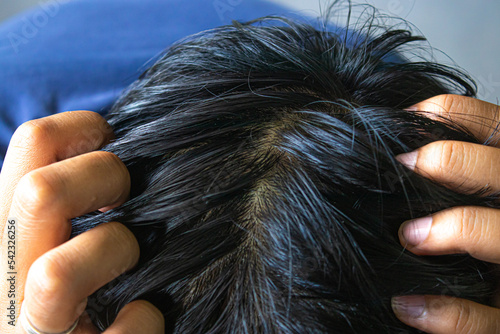 фотографія Closeup of thick hair on the scalp of a man's head.