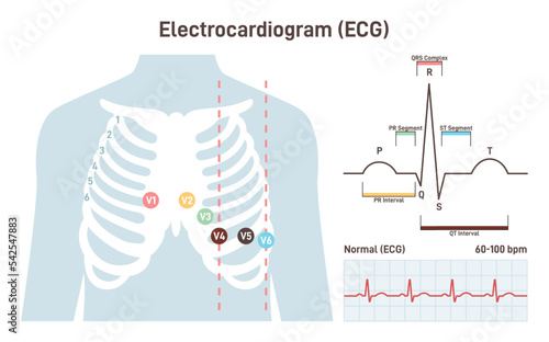 ECG procedure. Cardiovascular checkup with cardiogram. Heart disease