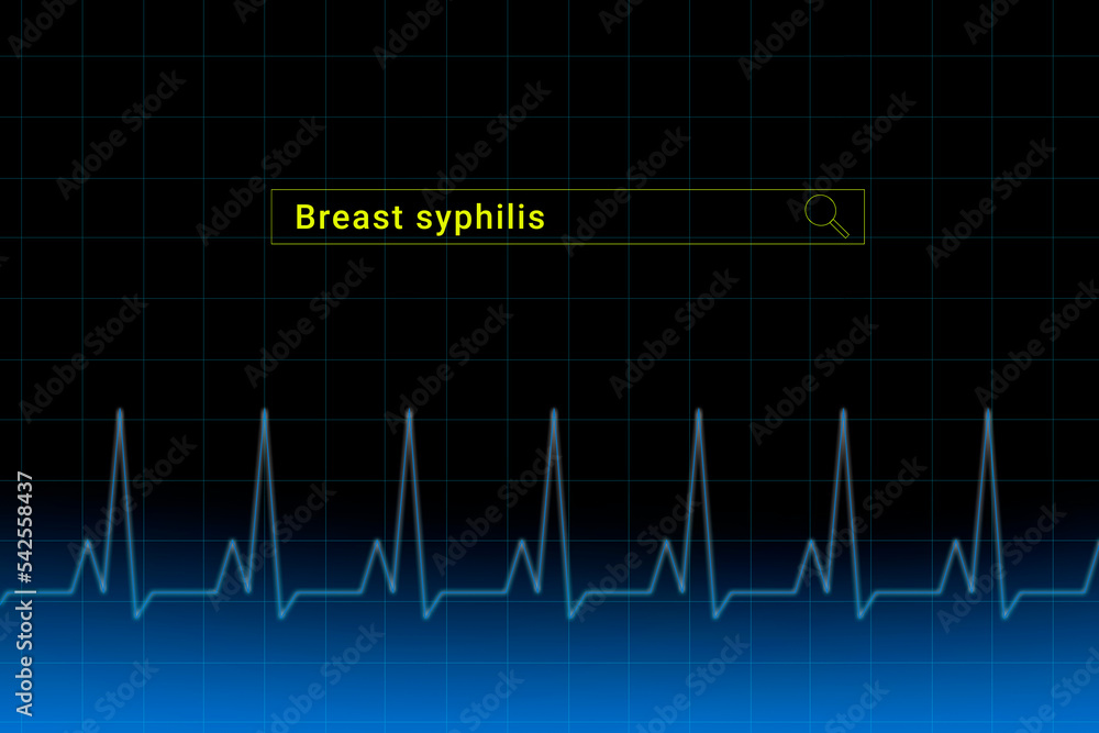 Breast syphilis.Breast syphilis inscription in search bar. Illustration with titled Breast syphilis . Heartbeat line as a symbol of human disease. Breast syphilis.Breast syphilis inscription in search bar. Illustration with titled Breast syphilis . Heartbeat line as a symbol of human disease.