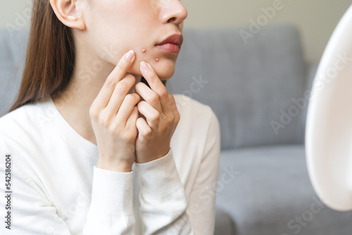 Expression worry asian young woman hand touching pustule around the chin and mouth, allergic when wear mask, makeup, show squeezing pimple spot from face. Beauty care, skin problem by acne treatment. photo
