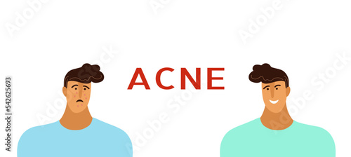 Young man or boy with acne, pimples, blackheads. Skin Teenager conditions concept. Flat doodle cartoon vector illustration for banner 