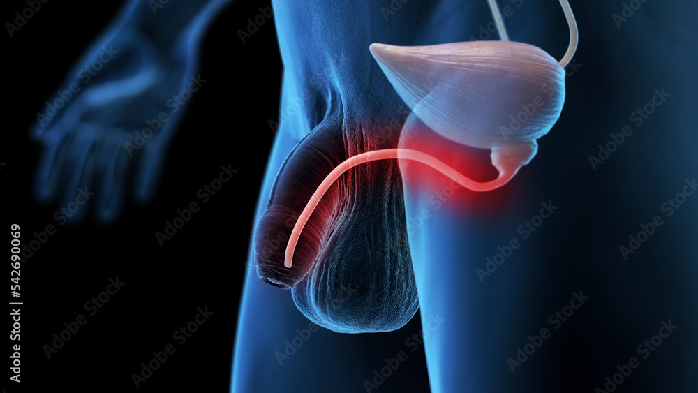 3d rendered medical illustration of an inflamed urethra 3d rendered medical illustration of an inflamed urethra