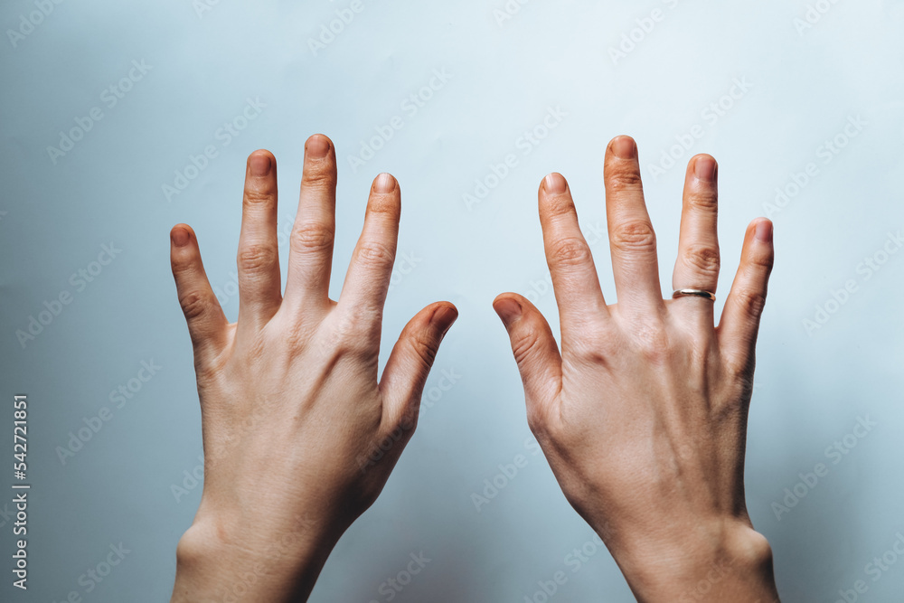 Ingrained dirt. Dirty caucasian hands isolated on a white background. Dyed palms by a fruit juice. Farmer work. Young woman hands. Hard female manual job. Short nails without manicure. Painted skin Ingrained dirt. Dirty caucasian hands isolated on a white background. Dyed palms by a fruit juice. Farmer work. Young woman hands. Hard female manual job. Short nails without manicure. Painted skin