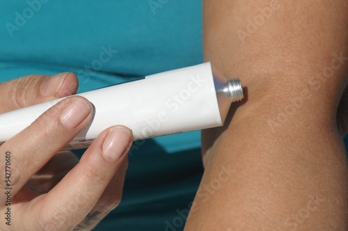 Topical pain of the elbows.