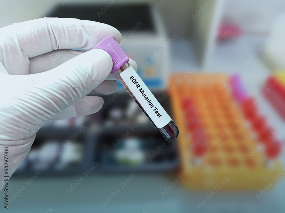 Fototapeta premium Lab Technologist holds blood sample for EGFR mutation test with laboratory background. Diagnosis of lung disease.