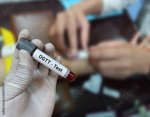 Doctor holds blood sample for Oral Glucose Tolerance Test (OGTT). Three or Five Sample testing for the diagnosis of the tolerance of blood glucose in body. World Diabetes day