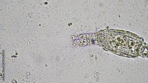 rotifer in a soil compost sample on a farm in America 