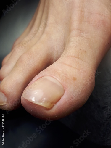 Old woman’s foot with fresh clear pedicure with glare