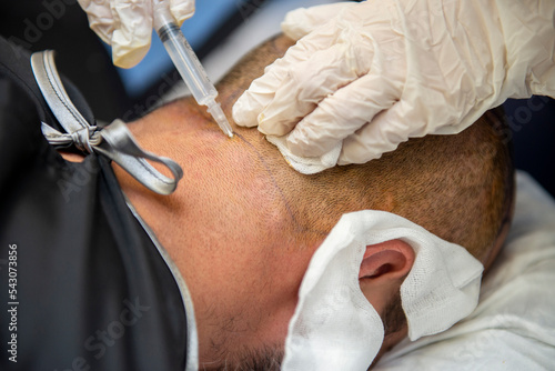 Hair Transplant Recovery