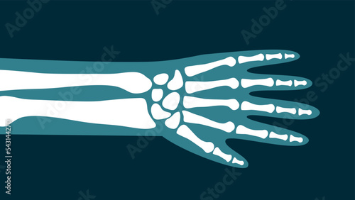 X-ray image of the hand photo
