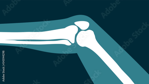 x-ray image of the knee joint on a black background