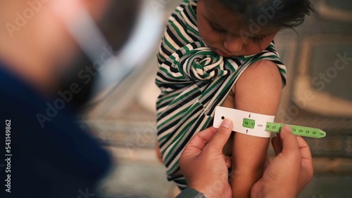 A doctor examines children's malnutrition inside a refugee camp. Malnutrition was measured using a mid-upper arm circumference belt.  photo