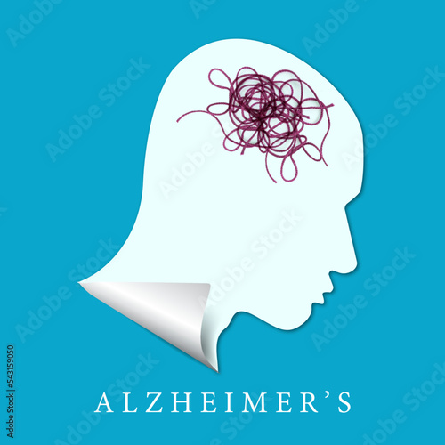 Alzheimers illustration