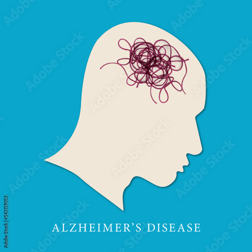 Alzheimers illustration