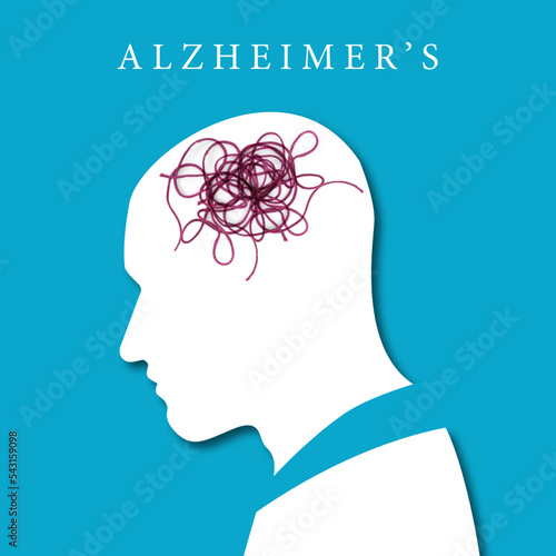 Alzheimers illustration