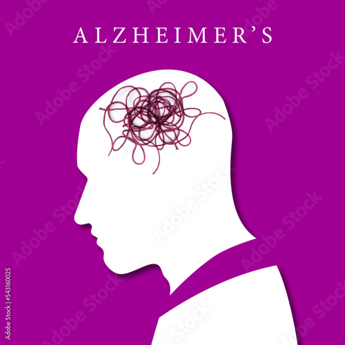 Alzheimer Krankheit