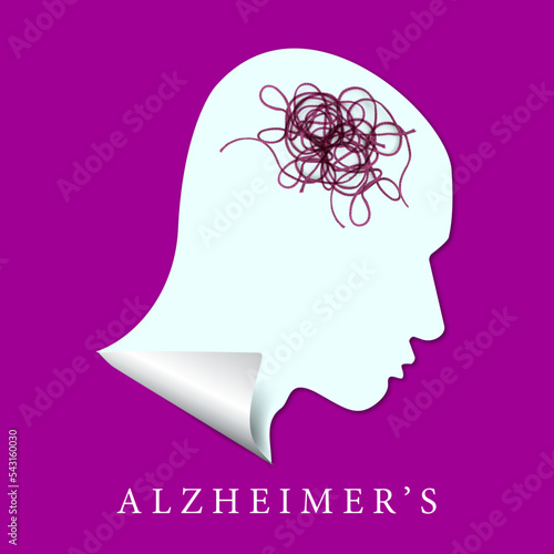Alzheimer Krankheit