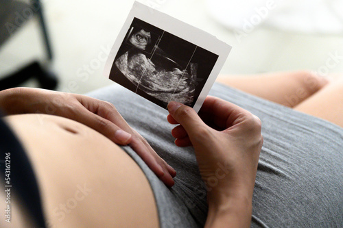 Pregnant woman holding and looking sonogram or ultrasonography picture of her unborn baby photo