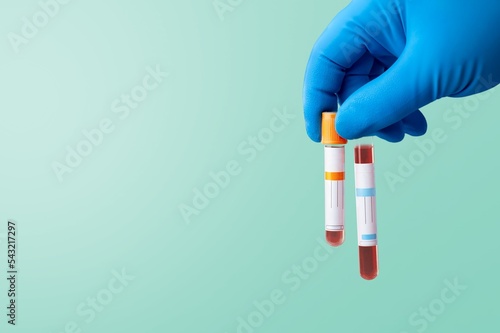 Hand of doctor holds a sample for test
