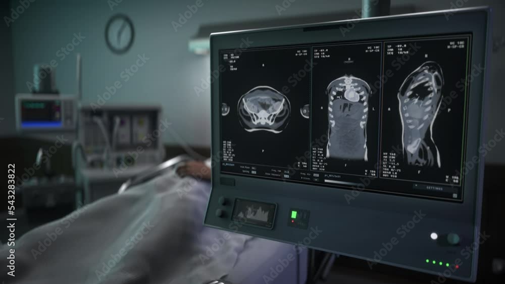 Xray Device Checks Organs Health In Human Body Before Surgery At