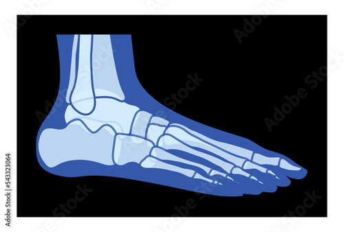 X-Ray Foot Legs Skeleton Human body Bones - malleolus, Phalanges adult people roentgen side view. Realistic flat blue color concept Vector illustration of medical anatomy isolated on black background