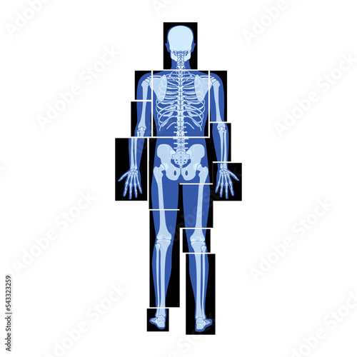 Set of X-Ray Skeleton Human body parts - hands, legs, chest, head, vertebra, pelvis, Bones adult people roentgen back view. 3D realistic flat blue color concept Vector illustration of medical anatomy