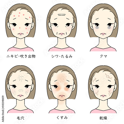 肌荒れに悩む女性セット　日本語補足あり　