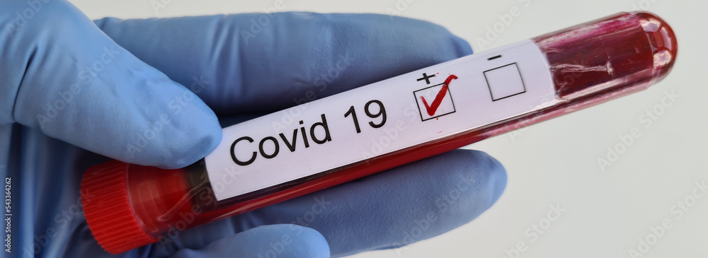 Obraz premium Doctor in glove holds test tube with positive covid-19 test