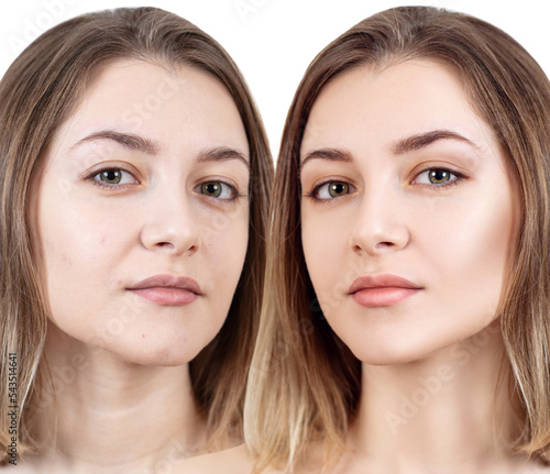 Face of beautiful woman before and after skin retouch.