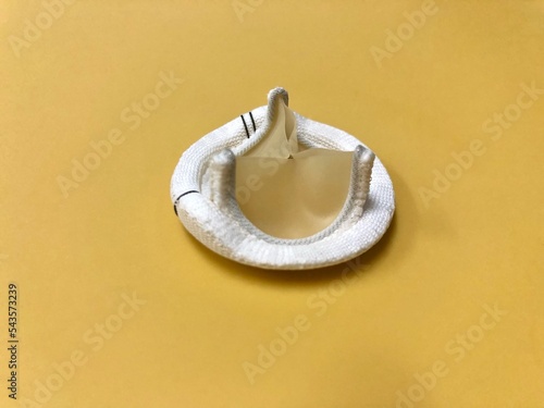 Model of bioprosthetic or tissue heart valve for valve replacement operation. photo