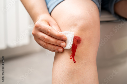 Obraz na płótnie Woman healing a first aid knee injury after having an accident at home