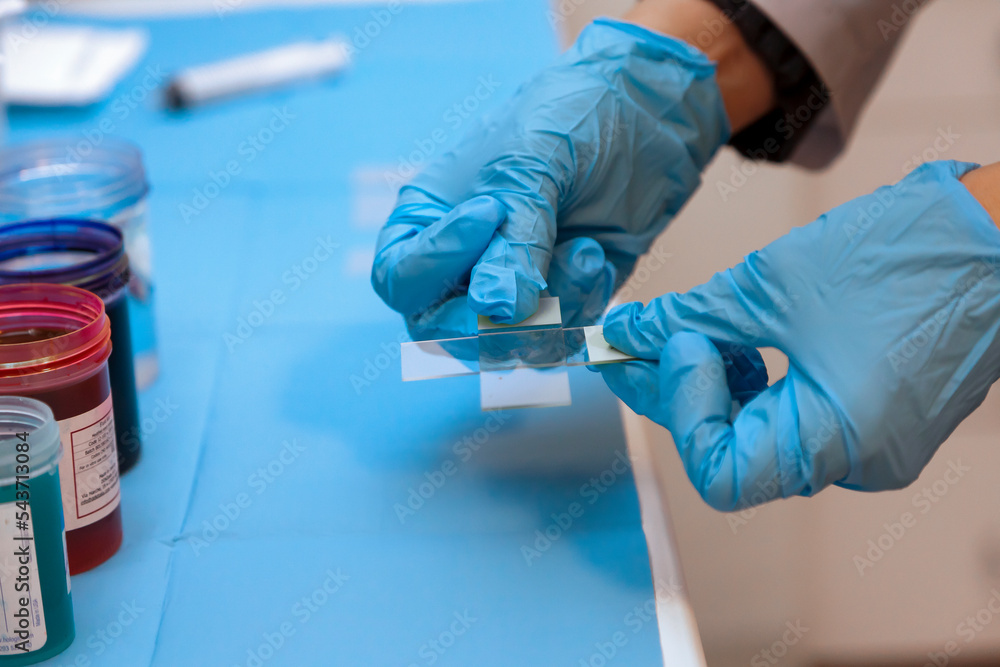 Histopathology stained slide which is ready for microscopic examination