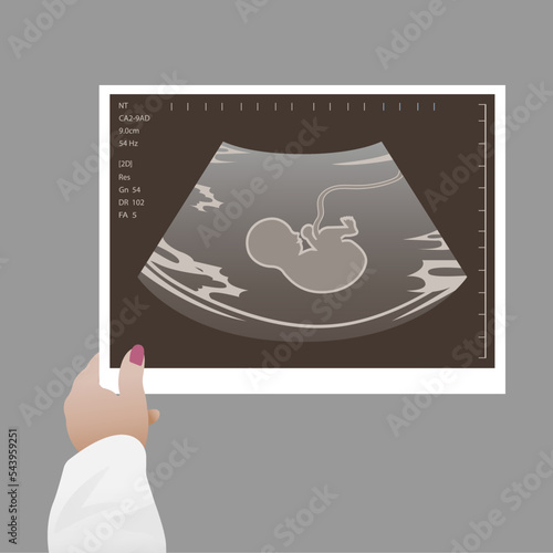 Ultrasound of a child. An ultrasound scan of the fetus of a pregnant woman. Medical diagnosis concept of a child in the womb, pregnancy and health, procedure for examining the embryo, placenta, umbili