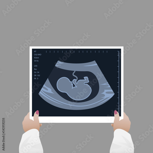 A female doctor looks at the result of an ultrasound scan. Medical diagnosis of a child in the womb, pregnancy and health, the procedure for examining the embryo, placenta, umbilical cord