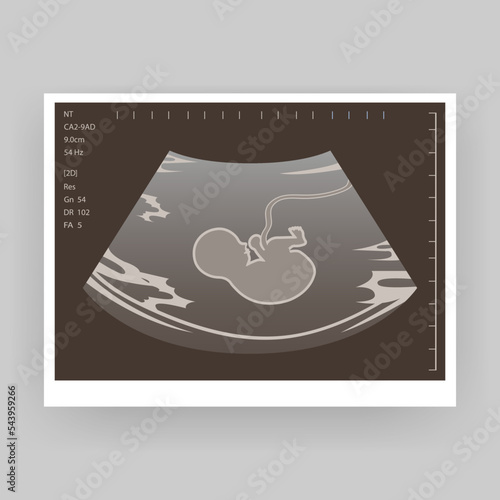 Ultrasound of a child. An ultrasound scan of the fetus of a pregnant woman. Medical diagnosis concept of a child in the womb, pregnancy and health, procedure for examining the embryo, placenta, umbili