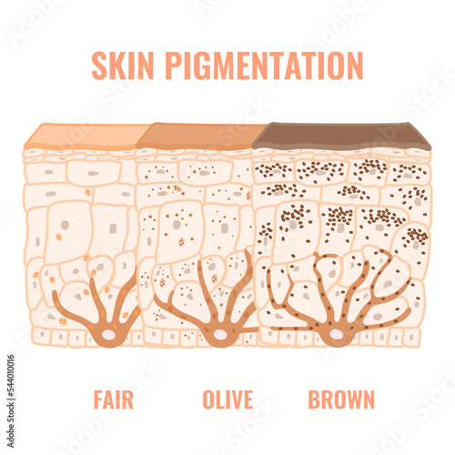 Melanin content and distribution in different skin tone phototypes. Pigmentation mechanism in dark, olive and light skin. Epidermis cross-section infographic medical diagram. Vector illustration.