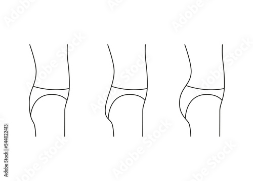 Types of butt woman, shape buttock side, line icon. Augmentation, reshape buttocks from small, flat in full booty. Cosmetic medical procedures, clinic of plastic surgery. Vector outline illustration