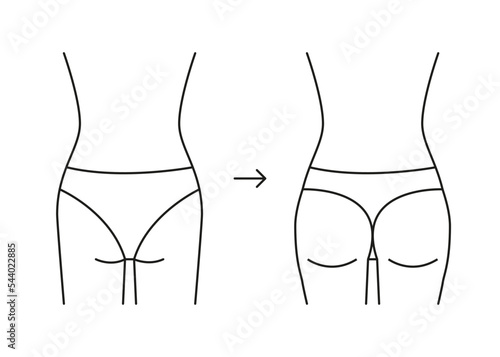 Types of butt woman, shape buttock back, line icon. Augmentation, reshape buttocks from small in full booty. Cosmetic medical procedures, clinic of plastic surgery. Vector outline